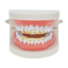 Load image into Gallery viewer, Custom Fit Hip Hop Grill - PLG