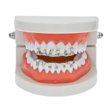 Load image into Gallery viewer, Custom Fit Hip Hop Grill - PLG